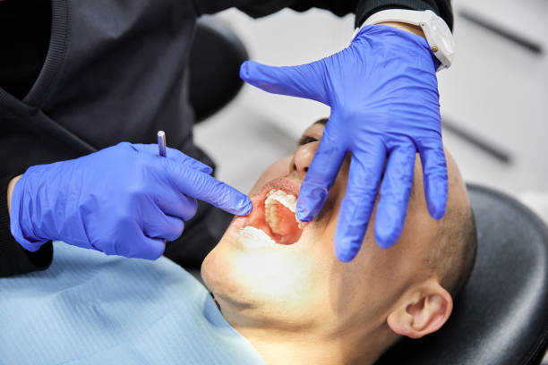Best Emergency Dentist for Knocked-Out Tooth in Valencia, NM